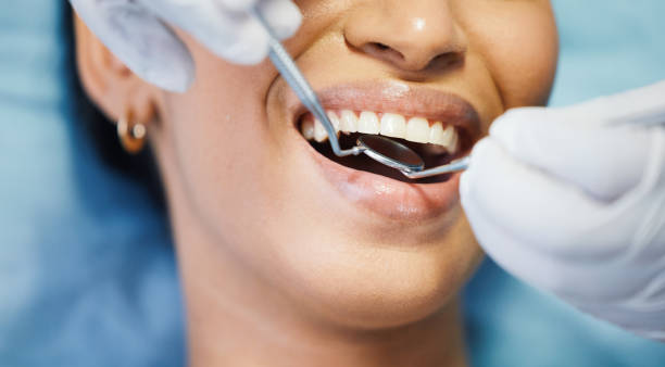 Best Emergency Dental Care for Broken or Chipped Teeth in Grand Island, NE