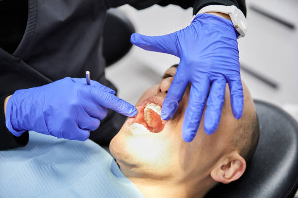 Best Urgent Care for Lost Fillings or Crowns in Grand Island, NE